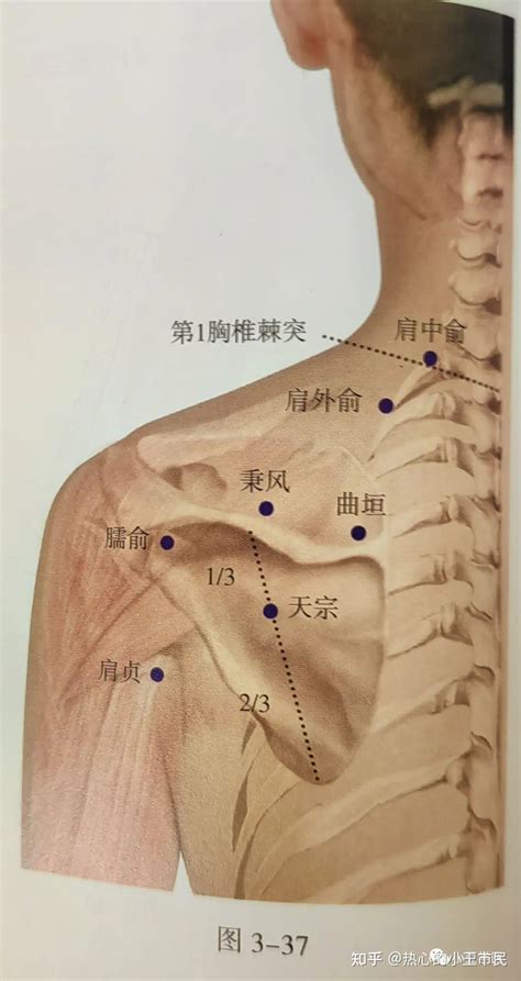 凤冠穴